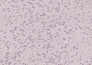 Phospho-PYK2 (Tyr402) Rabbit Polyclonal Antibody