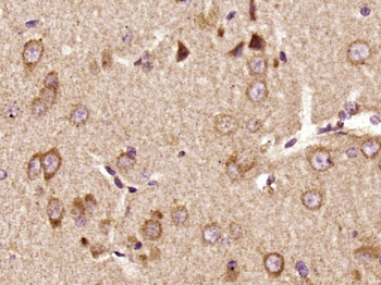 Phospho-PYK2 (Tyr402) Rabbit Polyclonal Antibody