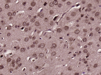 PLCG 2 Rabbit Polyclonal Antibody