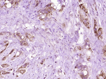 Phospho-PLCG 2 (Tyr759) Rabbit Polyclonal Antibody