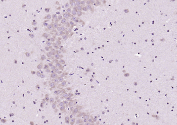 GABA Rabbit Polyclonal Antibody