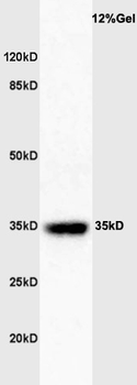 GATA1 Rabbit Polyclonal Antibody