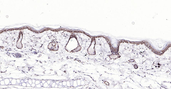 Bax Recombinant Rabbit Monoclonal Antibody