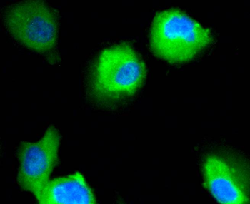 Neuropilin-1 Recombinant Rabbit Monoclonal Antibody