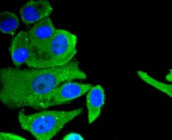 Neuropilin-1 Recombinant Rabbit Monoclonal Antibody