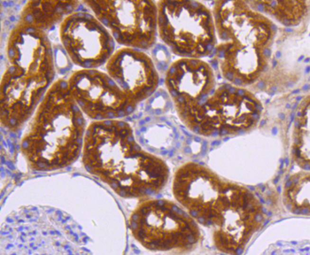 Neuropilin-1 Recombinant Rabbit Monoclonal Antibody