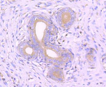 MEKK3 Recombinant Rabbit Monoclonal Antibody