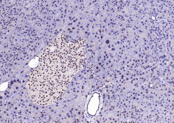 PSMA1 Recombinant Rabbit Monoclonal Antibody