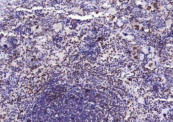 PSMA1 Recombinant Rabbit Monoclonal Antibody