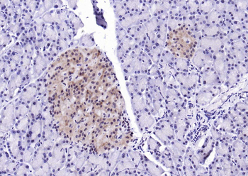 PSMA1 Recombinant Rabbit Monoclonal Antibody