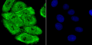PSMA1 Recombinant Rabbit Monoclonal Antibody