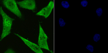 PSMA1 Recombinant Rabbit Monoclonal Antibody