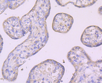 IKK gamma Recombinant Rabbit Monoclonal Antibody