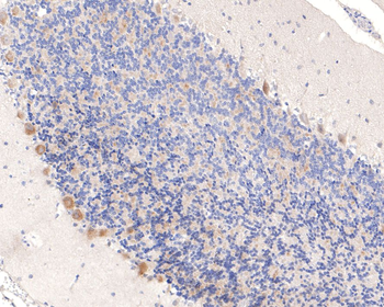 IKK gamma Recombinant Rabbit Monoclonal Antibody