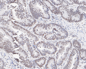 Phospho-ATM (Ser1981) Recombinant Rabbit Monoclonal Antibody