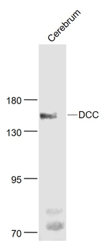 DCC Rabbit Polyclonal Antibody