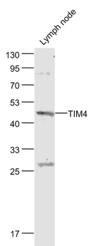 TIM4 Rabbit Polyclonal Antibody