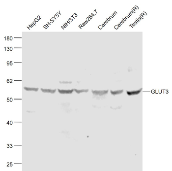 GLUT3 Rabbit Polyclonal Antibody