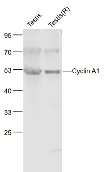 Cyclin A1 Rabbit Polyclonal Antibody
