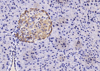 GLIPR1 Rabbit Polyclonal Antibody