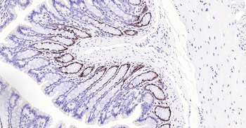 PCNA Recombinant Rabbit Monoclonal Antibody (Nuclear Loading Control)