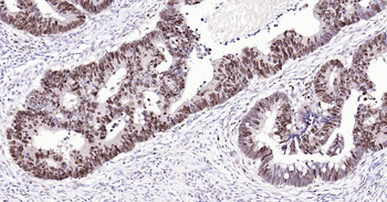 PCNA Recombinant Rabbit Monoclonal Antibody (Nuclear Loading Control)