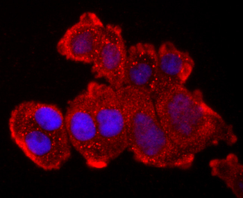 TNFR2 Recombinant Rabbit Monoclonal Antibody