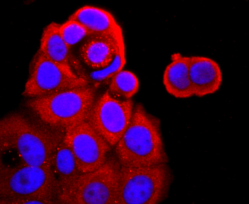 TNFR2 Recombinant Rabbit Monoclonal Antibody