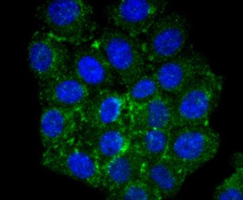 CPT2 Recombinant Rabbit Monoclonal Antibody