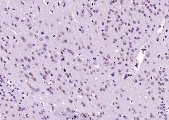 TFRC Recombinant Rabbit Monoclonal Antibody