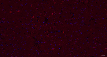 Trk A + B + C Recombinant Rabbit Monoclonal Antibody