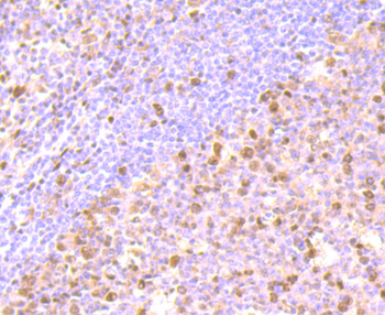 FKBP51 Recombinant Rabbit Monoclonal Antibody