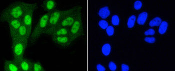 YAP1 Recombinant Rabbit Monoclonal Antibody
