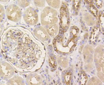 YAP1 Recombinant Rabbit Monoclonal Antibody
