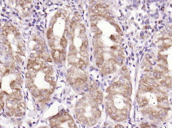 ADAM28 Rabbit Polyclonal Antibody