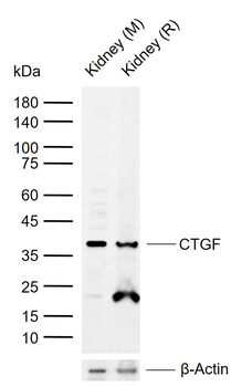 CTGF Rabbit Polyclonal Antibody