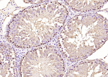 Phospho-HDAC7 (Ser358) Rabbit Polyclonal Antibody