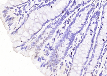 Phospho-HDAC4 (Ser246) + HDAC5 (Ser259) + HDAC7 (Ser155) Rabbit Polyclonal Antibody
