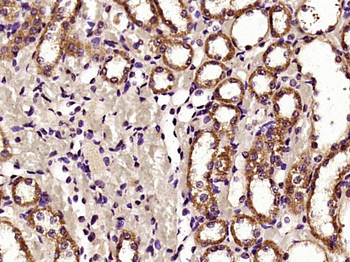 HDAC6 Rabbit Polyclonal Antibody