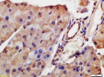 HDAC8 Rabbit Polyclonal Antibody