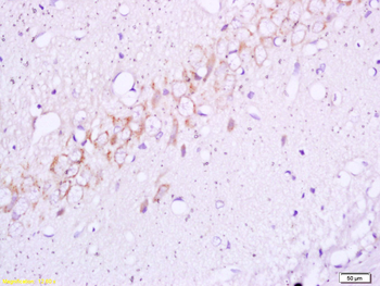 Phospho-Insulin Receptor Beta (Tyr1355) Rabbit Polyclonal Antibody