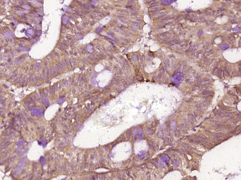 Phospho-IRAK1 (Thr209) Rabbit Polyclonal Antibody
