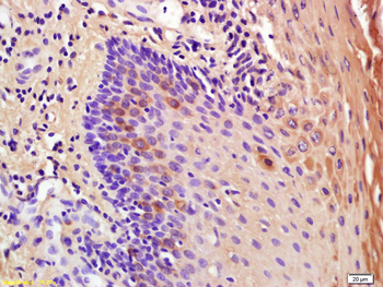 IL-1RA Rabbit Polyclonal Antibody