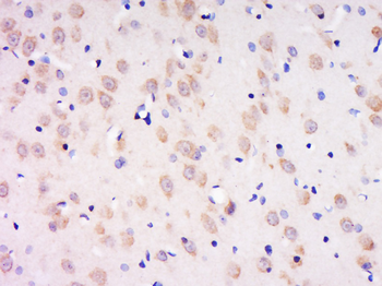 Phospho-Kv2.1 (Tyr128) Rabbit Polyclonal Antibody
