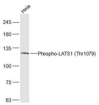 Phospho-LATS1 (Thr1079) Rabbit Polyclonal Antibody