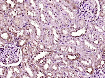 Phospho-MAPKAPK2 (Thr222) Rabbit Polyclonal Antibody