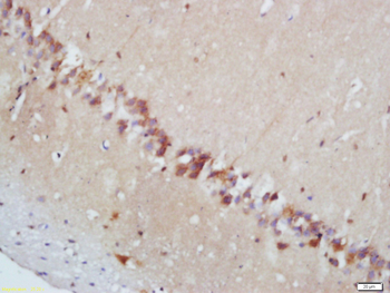 Phospho-MAPKAPK2 (Thr222) Rabbit Polyclonal Antibody