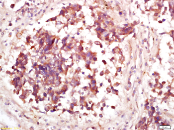 Phospho-MDM2 (Thr218) Rabbit Polyclonal Antibody