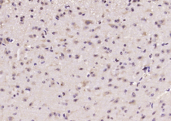Phospho-mTOR (Ser2481) Rabbit Polyclonal Antibody