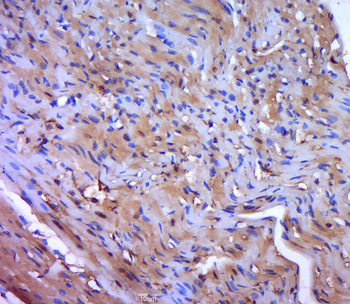 MYL9 Rabbit Polyclonal Antibody